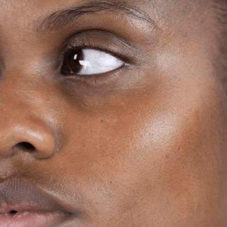 SCREEN STAR – VicoSkin